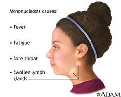 symptoms of mono in adults